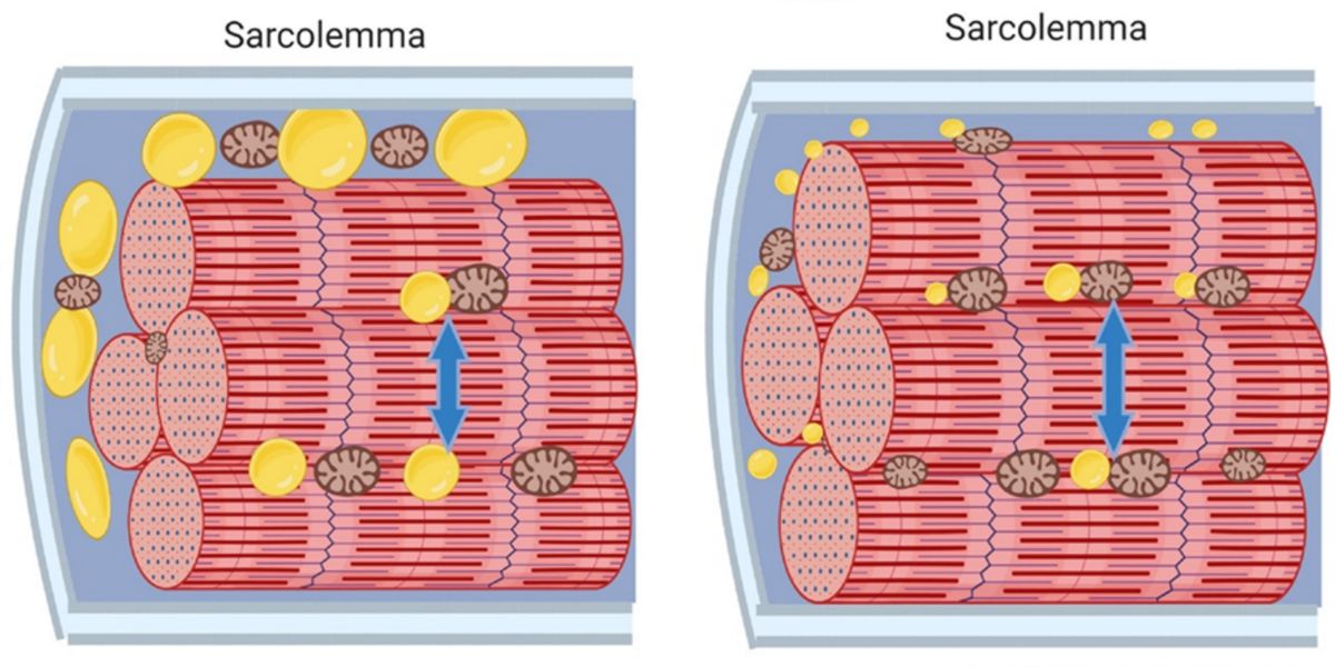 Disposition des lipides et densité mitochondriale intermiofibrillaire