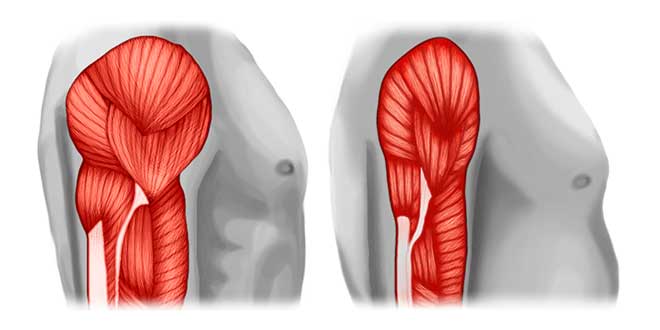 Sarcopenia