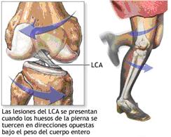 IMAGEN 1 18º post parte II
