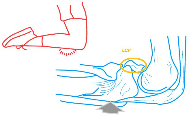 IMAGEN 1 18º post parte III