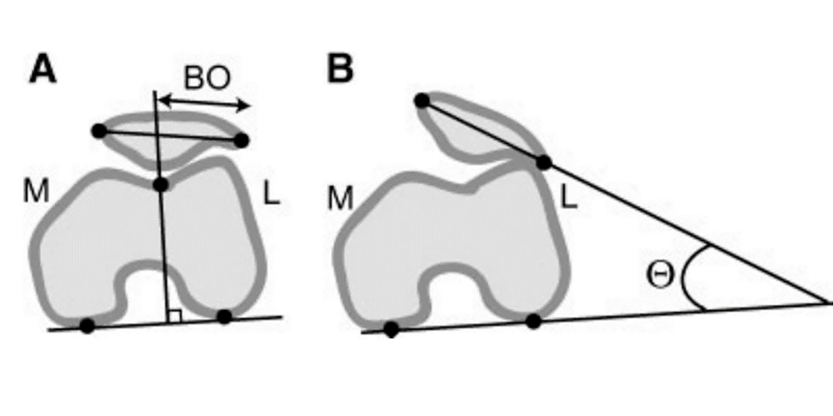 Efectos rodillera