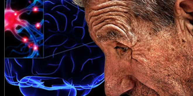 Ejercicio físico específico para el Parkinson Ejercicio físico específico para el Parkinson