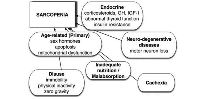 Fisiopatogénesis de la sarcopenia