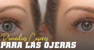 Remedios caseros para las ojeras