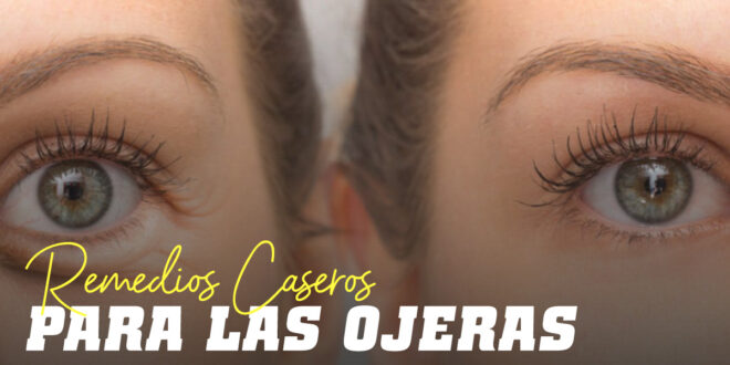 Ojo a las Ojeras: Te contamos los Mejores Remedios Caseros