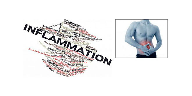 Tests intolerancia alimentaria: ¿vivimos inflamados? Tests intolerancia alimentaria: ¿vivimos inflamados?