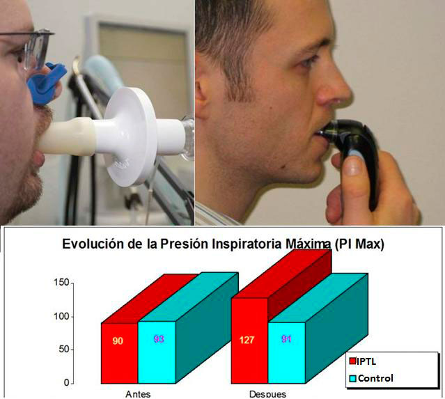 evolucion-presion-respiratoria