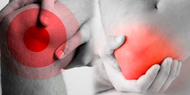 Suplementos para lesiones Suplementos para lesiones