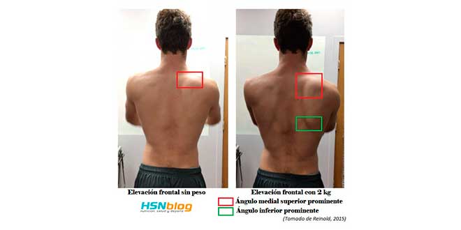flexion-hombro
