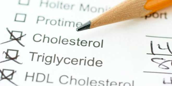 Niveles de Colesterol