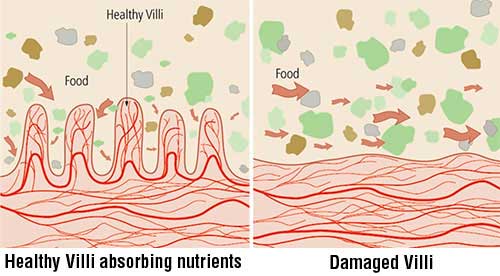 vellosidades intestinales