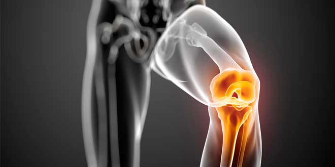causas-dolor-rodillas