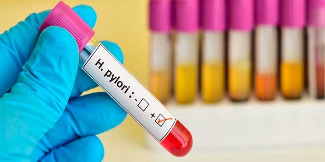 Pruebas para H. Pylori