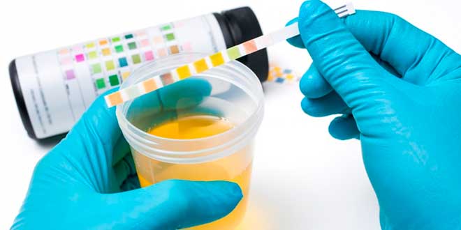 Diagnóstico Infección Urinaria