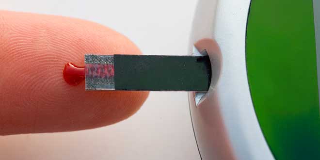 Diabete e niacinamide