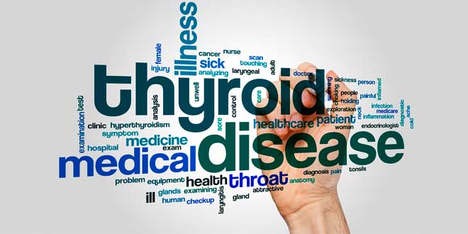 Hyperthyroidism