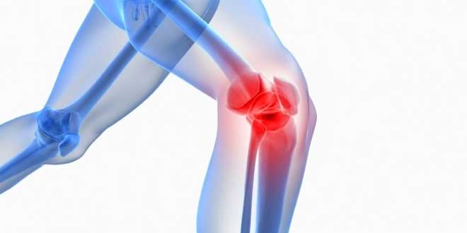 SAMe et ostéoarthrite