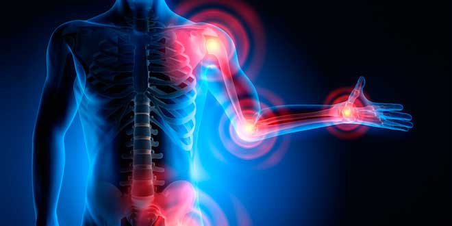 ¿Qué es la Inflamación? Qué es la inflamación