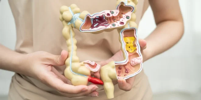 ¿Cómo se destruye la flora intestinal? ¿Cómo se destruye la flora intestinal?