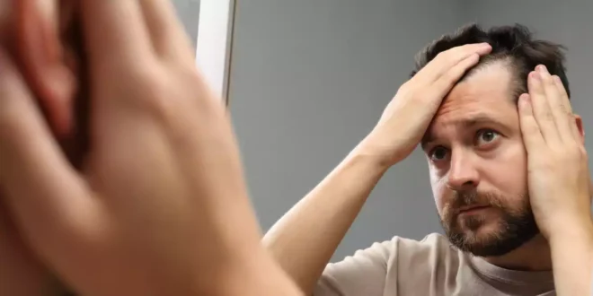 Cómo tratar la alopecia y evitar la caída del pelo