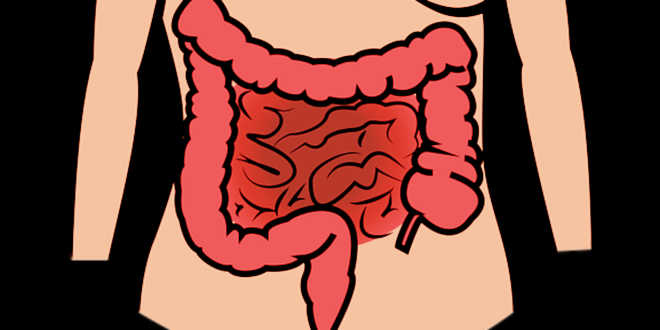 Intestino permeable Intestino permeable