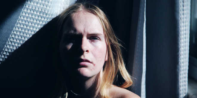 Acné no sólo se da en los adolescentes