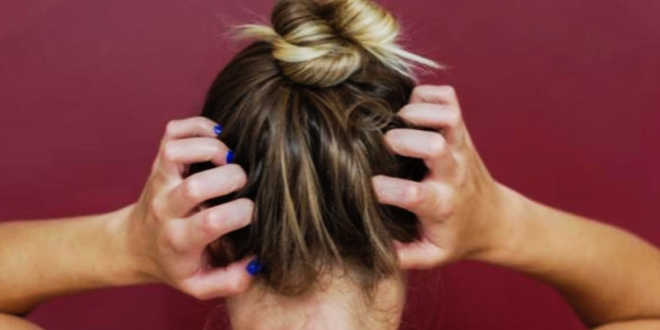 Dermatitis seborreica causas Dermatitis seborreica causas