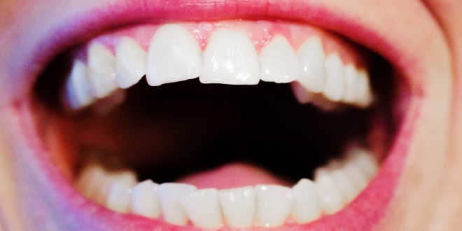 Treonina para los dientes