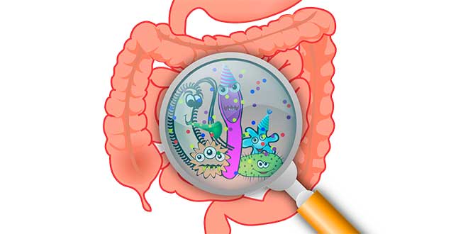 ¿Qué es el Sobrecrecimiento Bacteriano o SIBO? ¿Qué es el Sobrecrecimiento Bacteriano o SIBO?