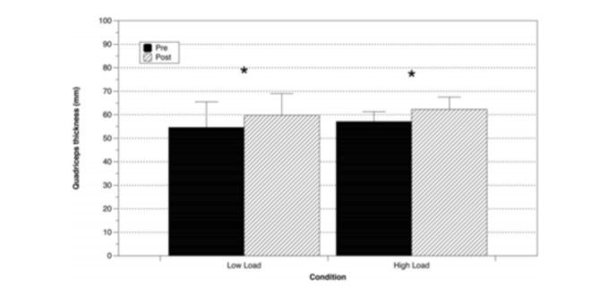 Hypertrophie, section transversale