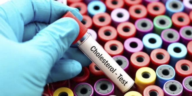 Test de Cholestérol