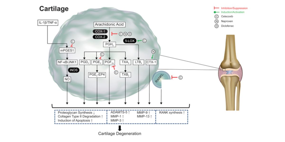 Dégénérescence du cartilage