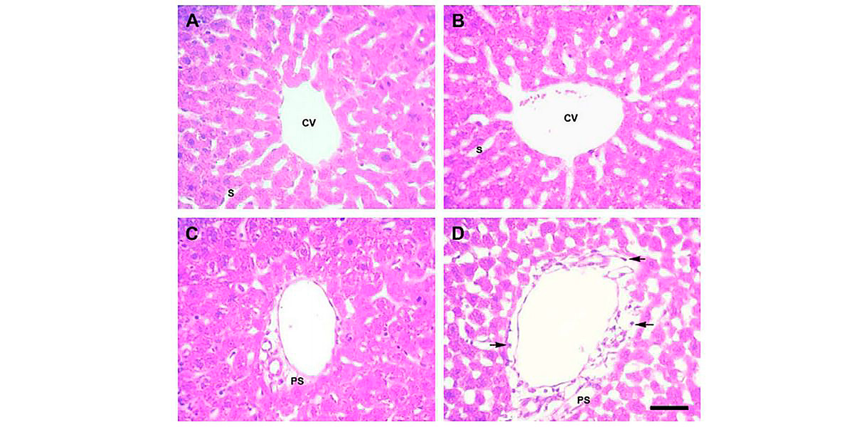 Lobule Hépatique
