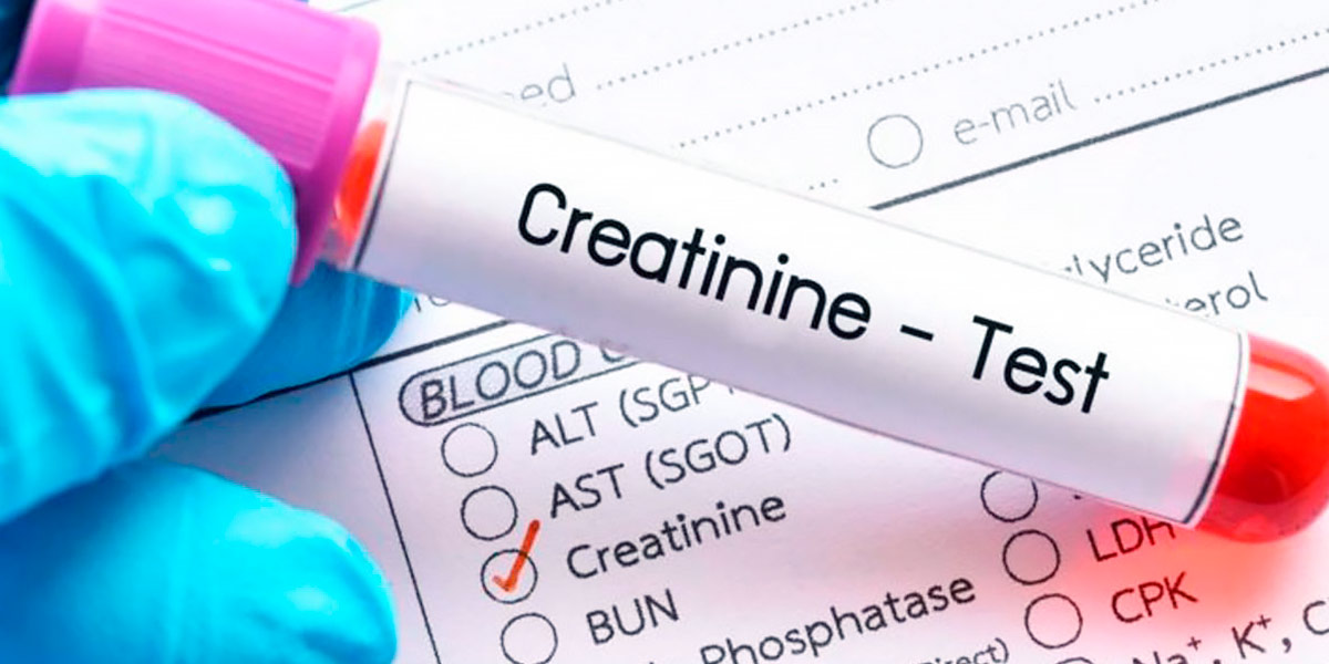 Créatinine