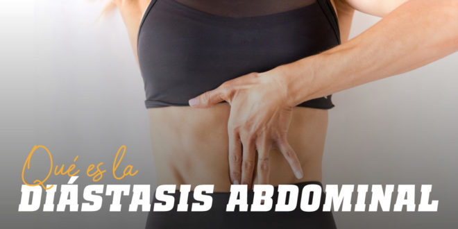 Diástasis Abdominal: Qué es, Cómo Prevenirla y Falsos Mitos Diástasis Abdominal: Qué es, Cómo Prevenirla y Falsos Mitos