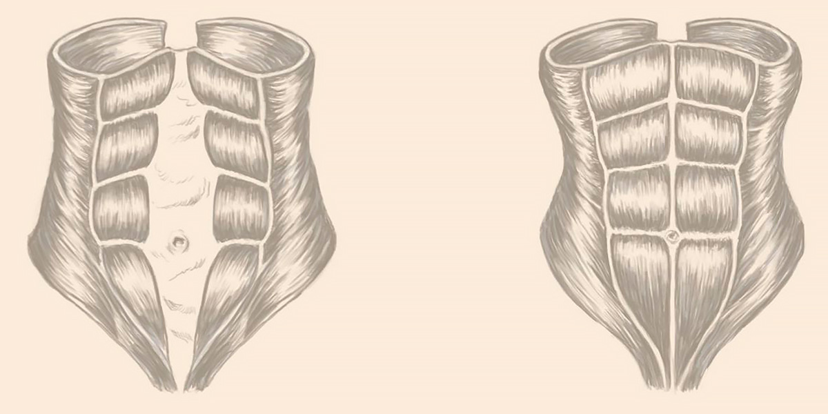 Séparation de l’abdomen