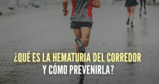 ¿Qué es la Hematuria del corredor y cómo prevenirla?