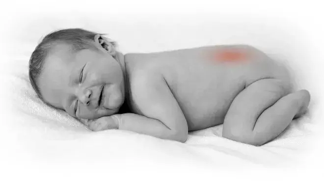 Para qué sirve el Ácido Fólico Para qué sirve el Ácido Fólico