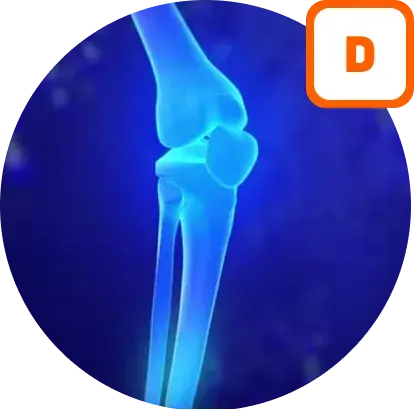 Vitamin D in bone development